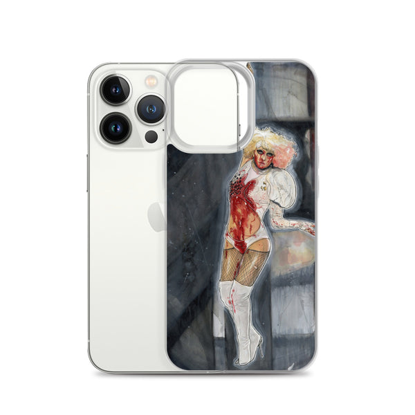 PAPARAZZI - iPhone Case